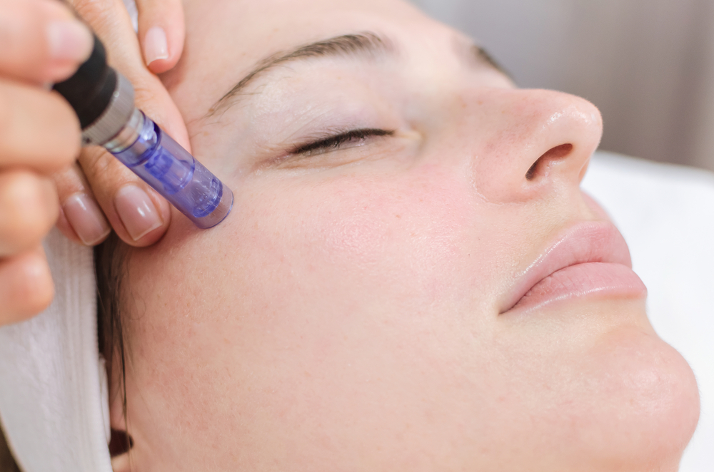 MesoTherapy Treatment for Face/ Body